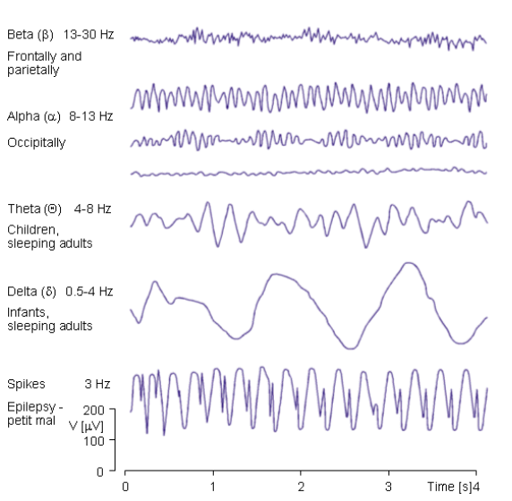 Frequency bands of EEG