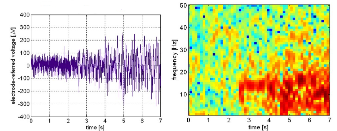 LFP graphs
