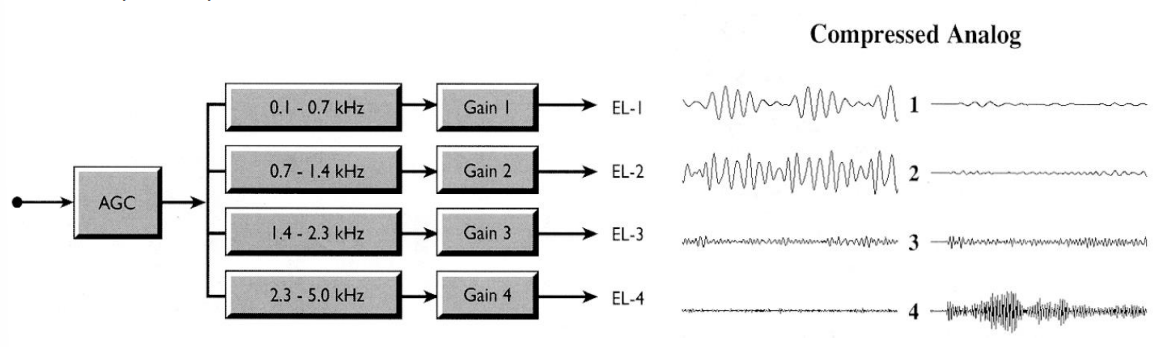 Compressed Analogue Cochlear Implant