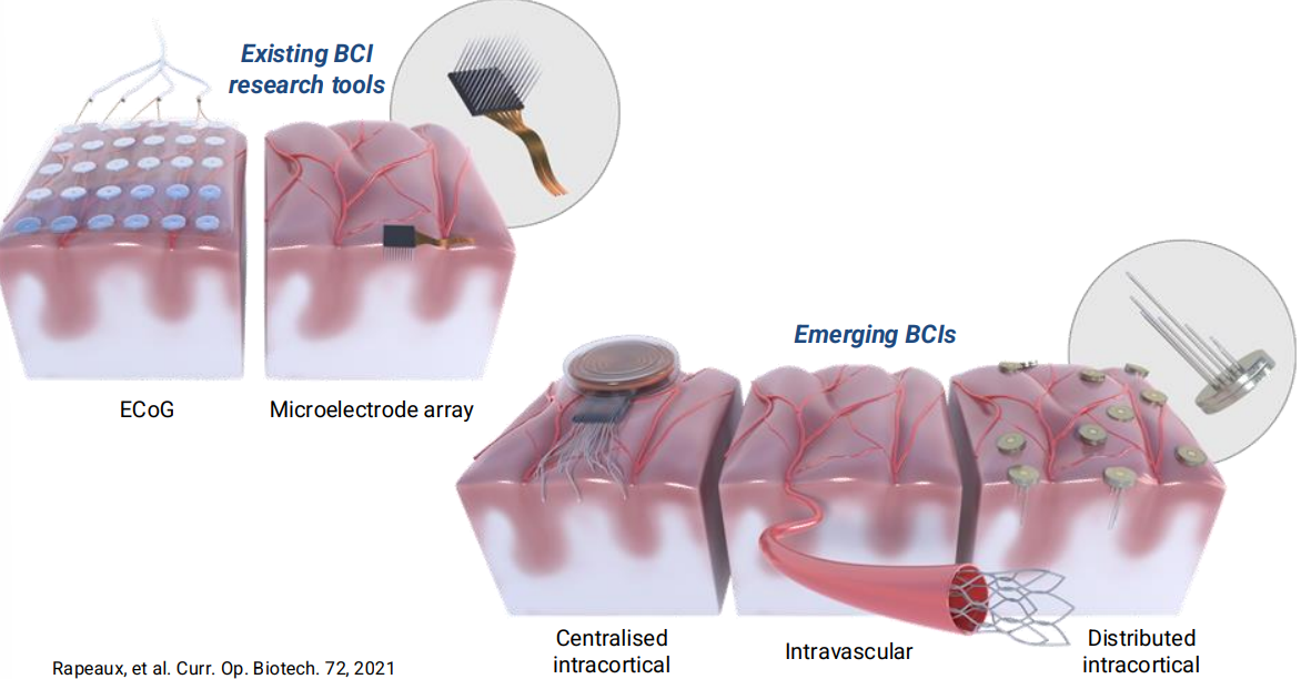 implantableBMI