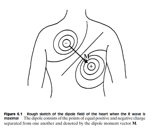 Body Diagram of Heart Electrode Measurements for ECG