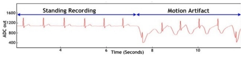 Motion Artifact Example
