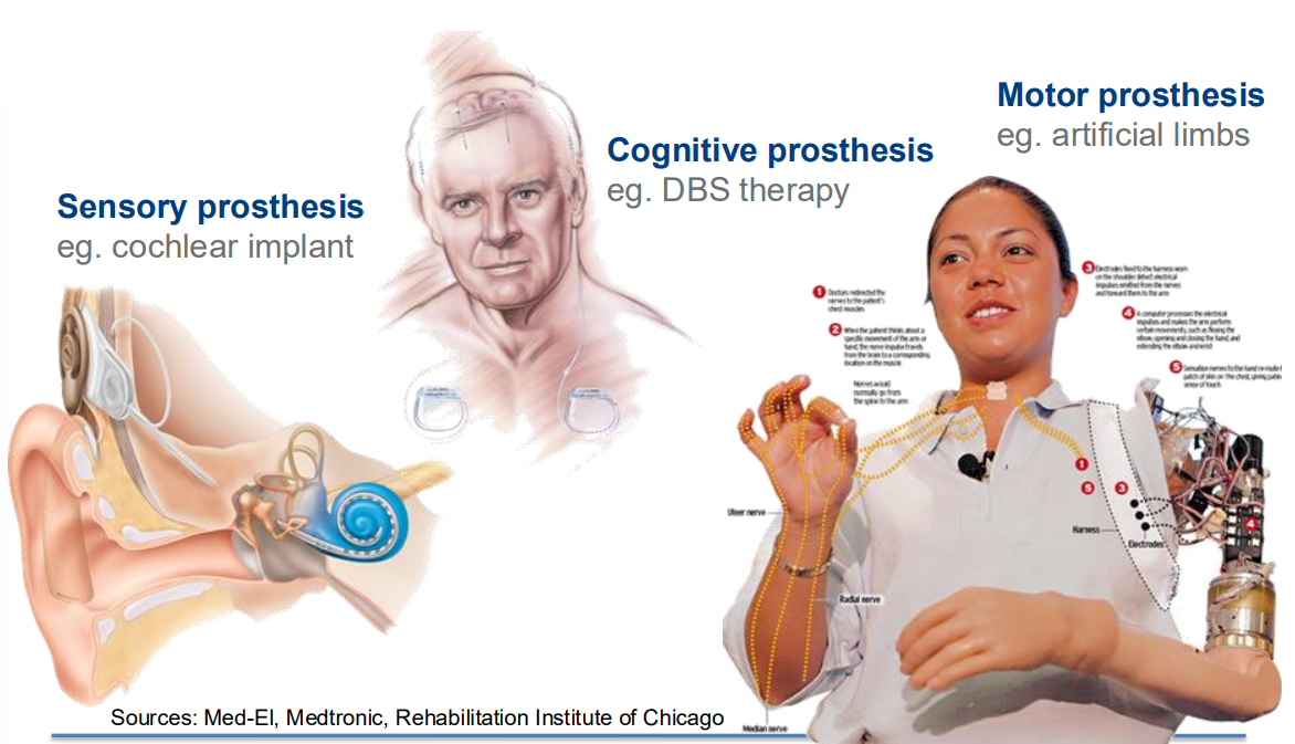 Images of different Neural Prosthetics