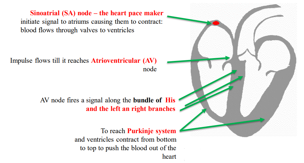 Pacemaker Heart Diagram