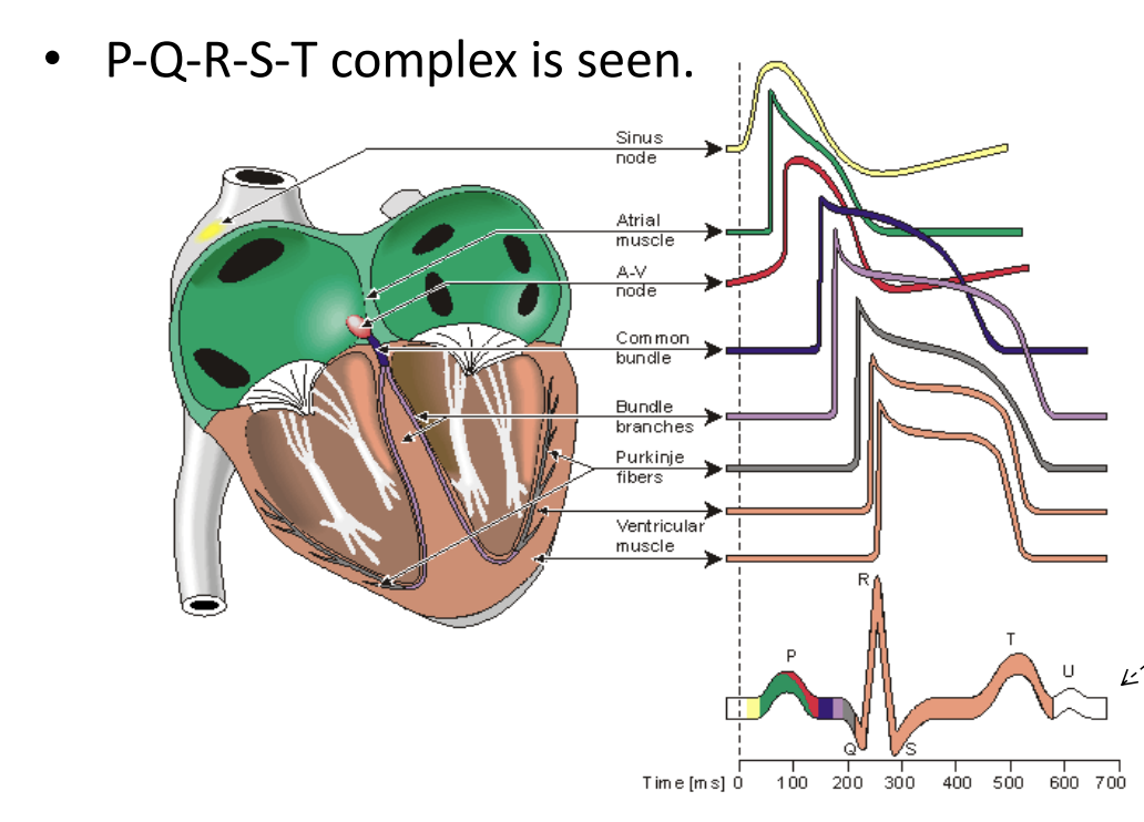 Signal Superposition for PQRST