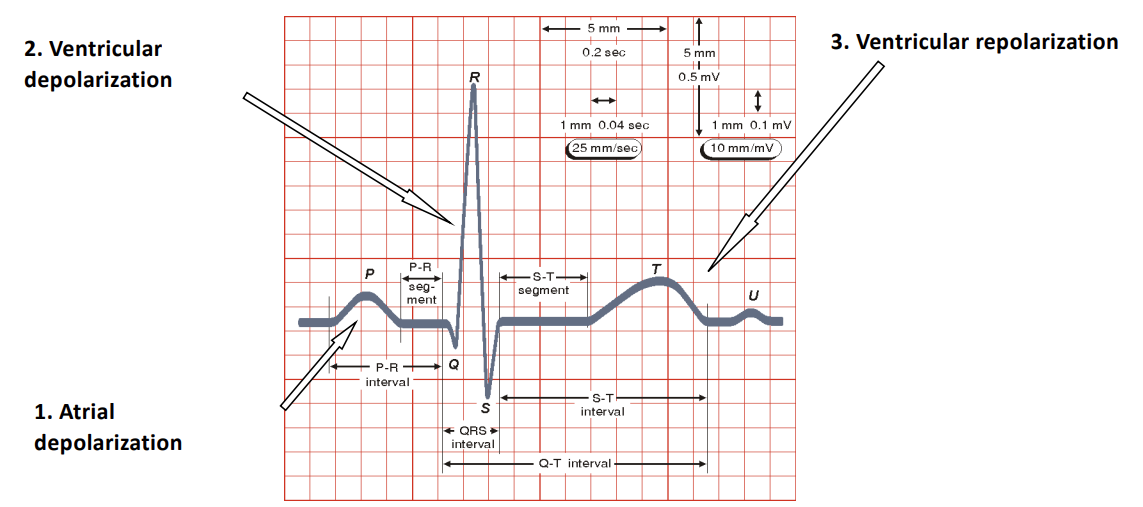 PQRST Diagram