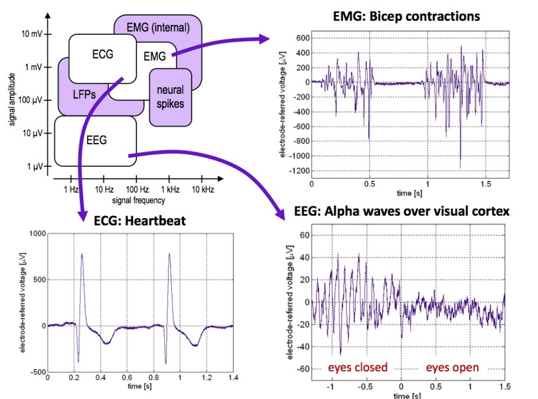 Signal Morphologies for ECG, EMG and EEG