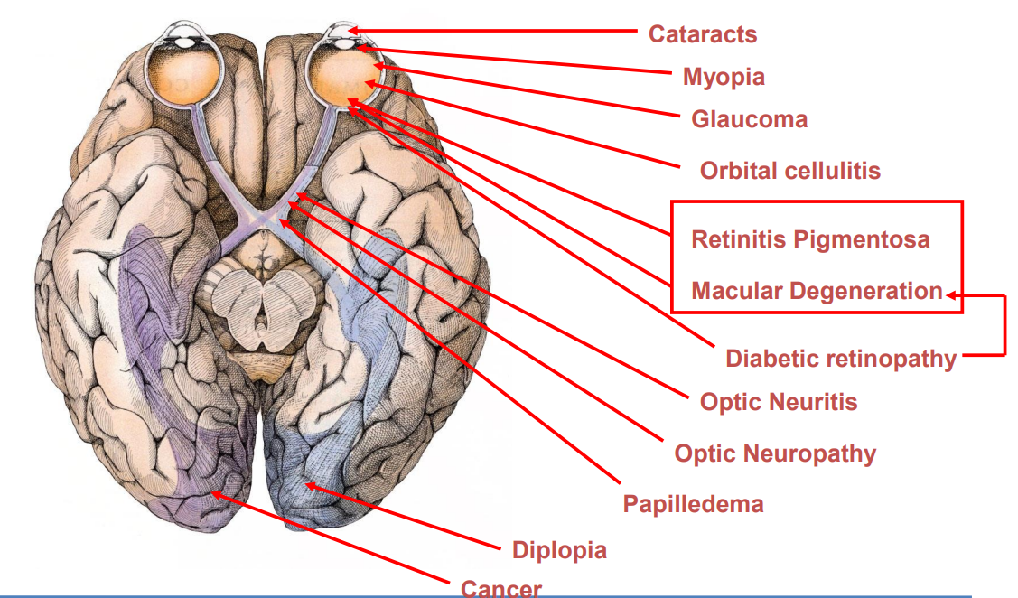 visualdisorder