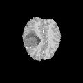 Brain tumour segmentation results